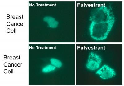Fulvestrant and Breast Cancer Cells