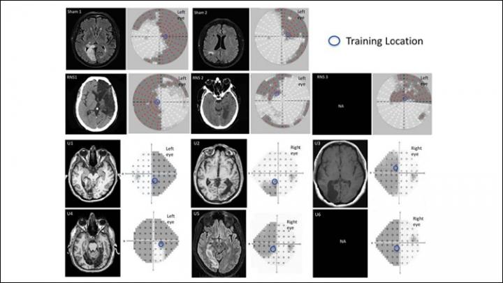 Neuroradiological Images