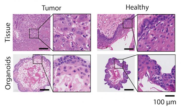 Healthy Versus Tumor Tissue and Organoids