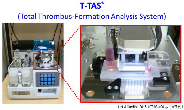 The Total Thrombus-Formation Analysis System (T-TAS®)