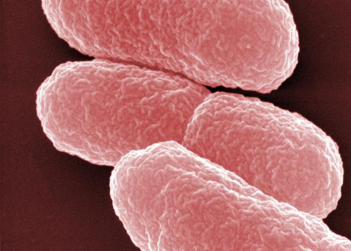 Electron micrograph of Escherichia coli