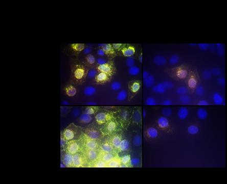 AR-12 Effect on SARS-CoV-2 Virus