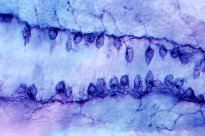 Sensory neurons in a zebrafish embryo.