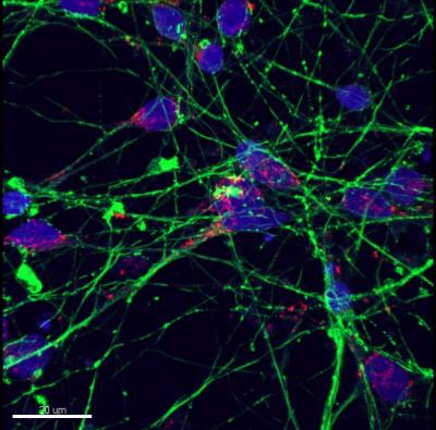 Striatal Neurons Generated from Corrected iPSCs
