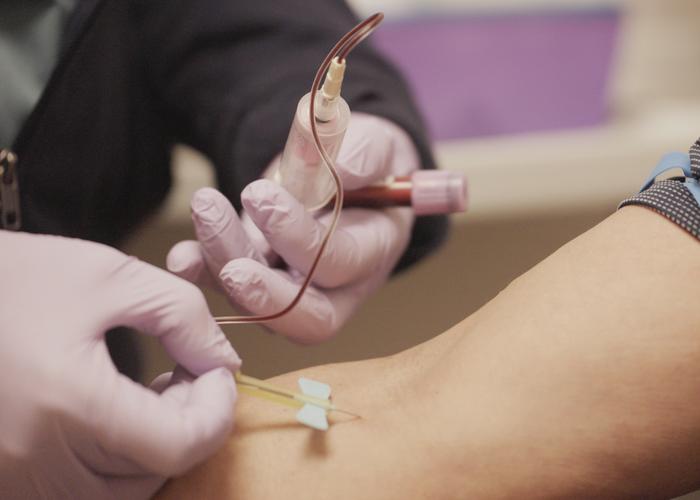 CAR T-cell therapy involves collecting a patient’s immune cells and engineering them to recognize and destroy cancer cells before returning them to the body through an IV infusion.