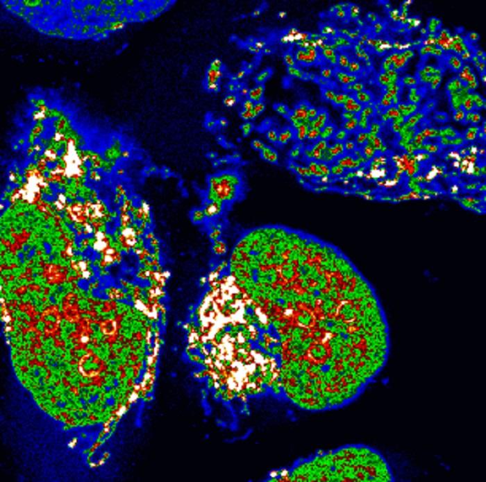 The New Probe inside Human Bone Cancer Cells