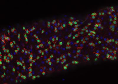 <i>Drosophila</i> Intestinal Stem Cells