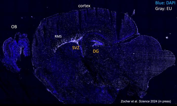 Cross-section of a one-year-old mouse brain