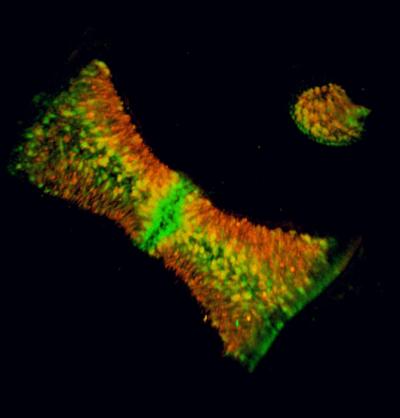 Inner Ear Sensory Patch