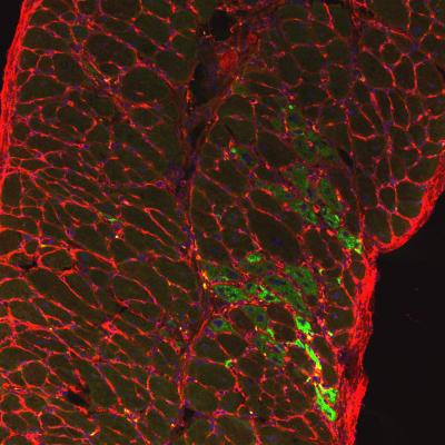 Diaphragm Muscle from SU9516