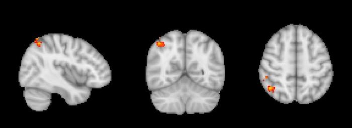 De Cates - brain images