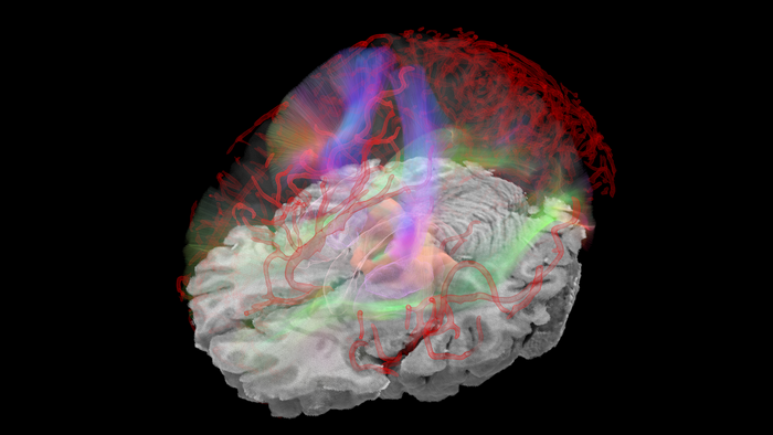 Diffusion tensor imaging (DTI)