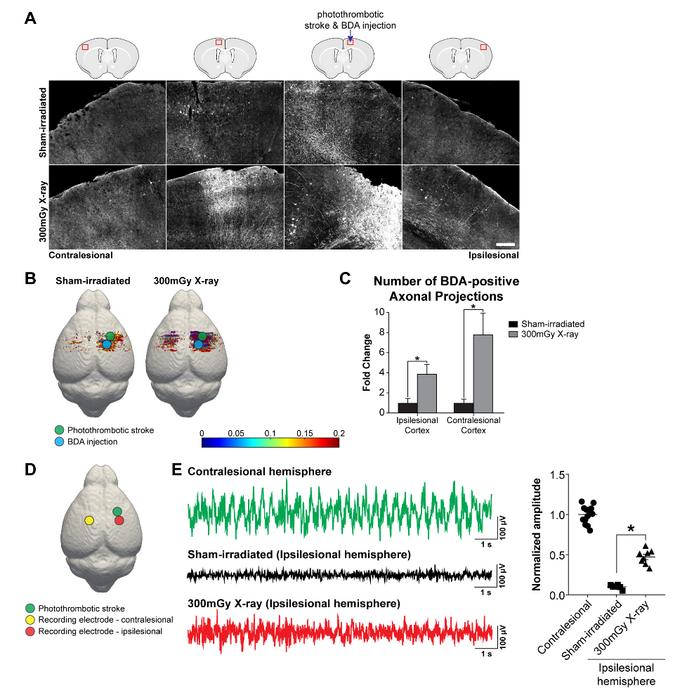 LDIR treatment induces axonal sprouting, brain rewiring and EEG oscillatory activity two months after ischemic stroke