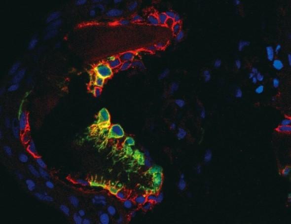OPC in the Niche of Fin Joint