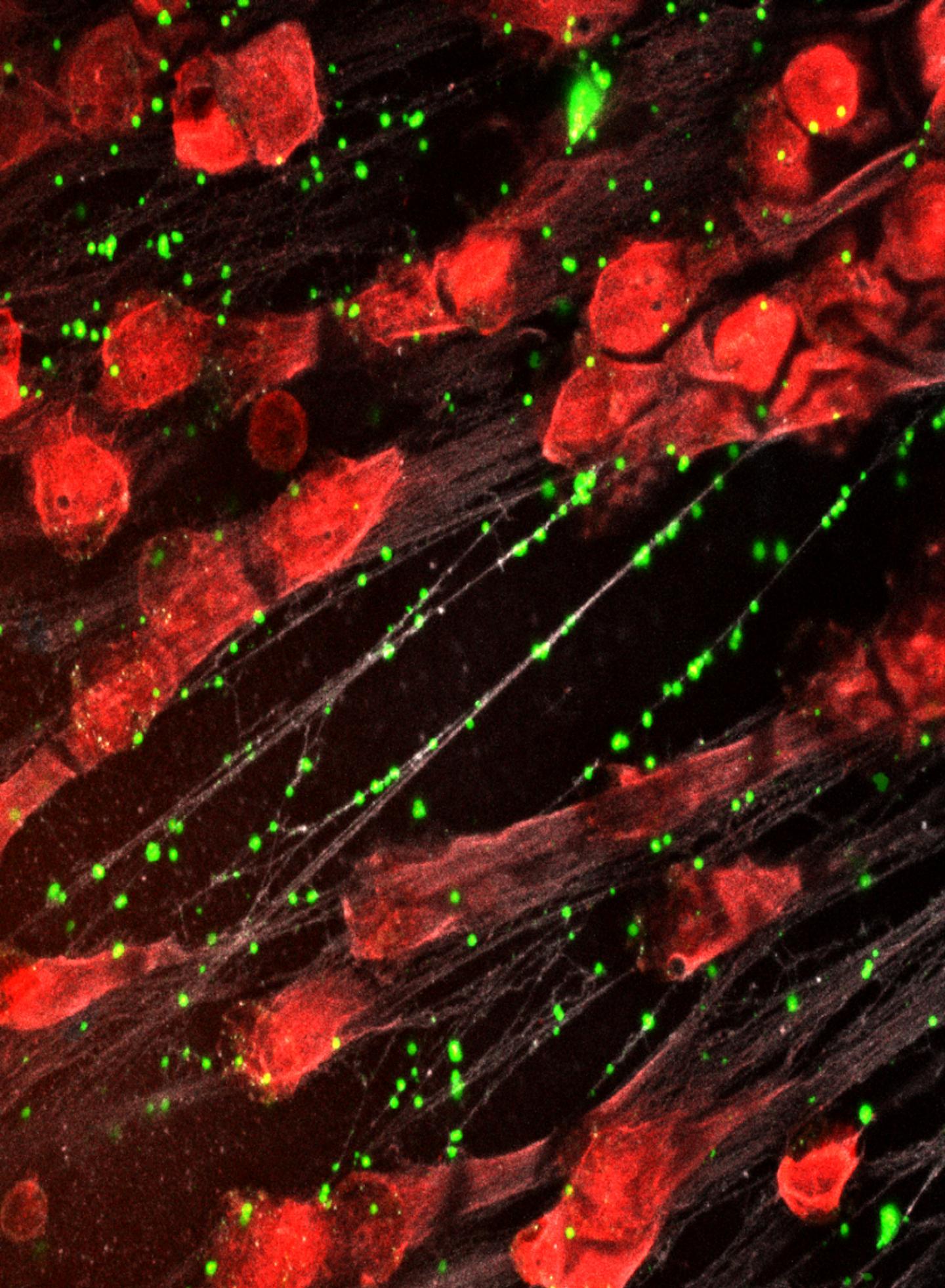 Enhancing the Capture of Deadly Bacteria