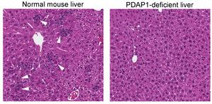 Liver Tissue With and Without PDAP1