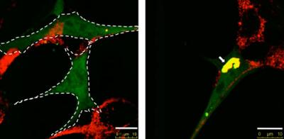 Accumulation of Defective Mitochondria