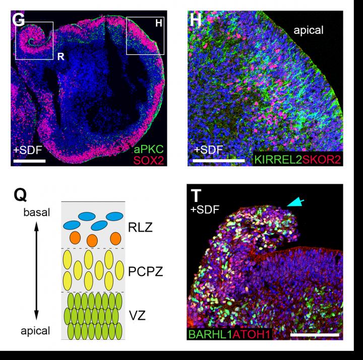 Continuous Neuroepithelium and Laminar Structure Induced by SDF1