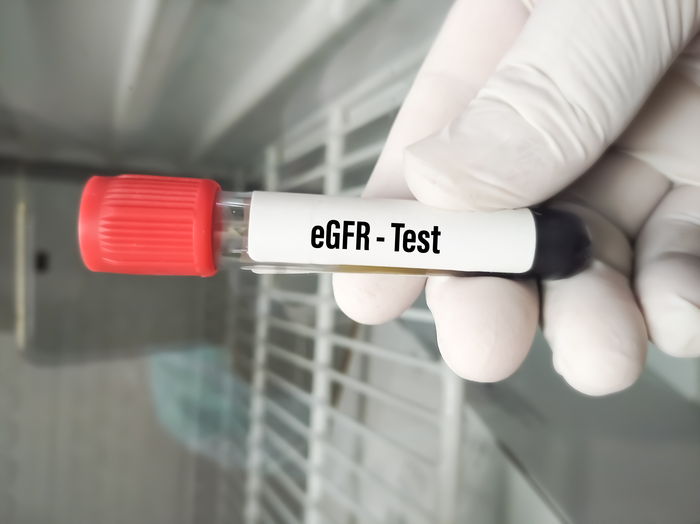 eGFR Blood Sample