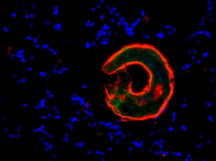 Staining of Infected Mouse Lung Tissue