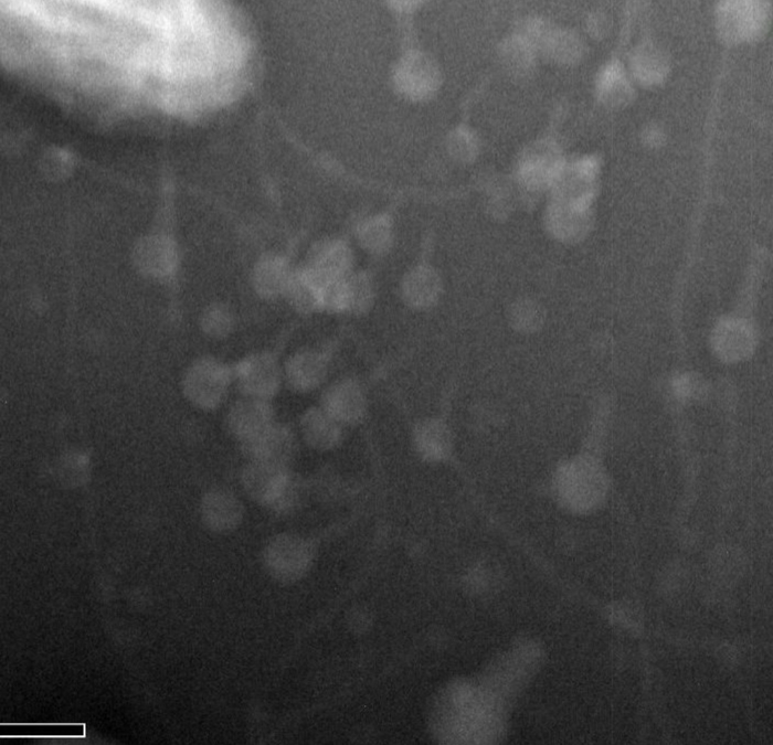 Transmission electron microscopy of a cyanophage infection