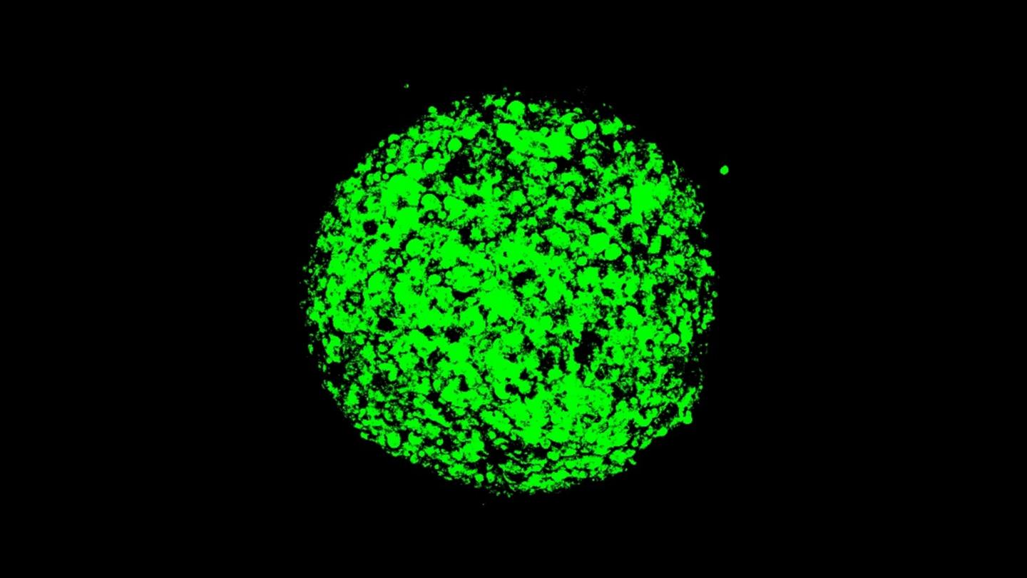 Mesothelioma [IMAGE] EurekAlert! Science News Releases