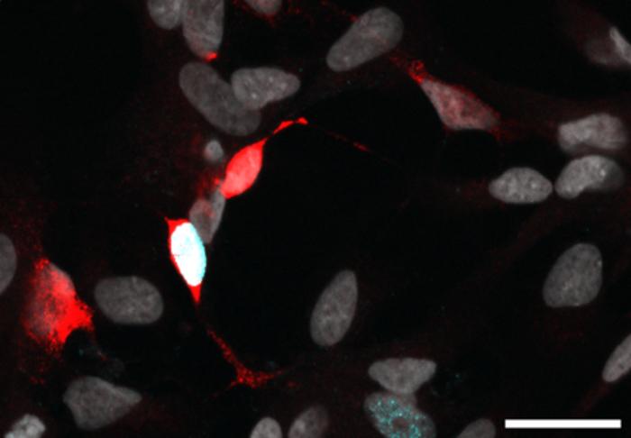 ASCL1 induces neurogenesis in human Muller glia