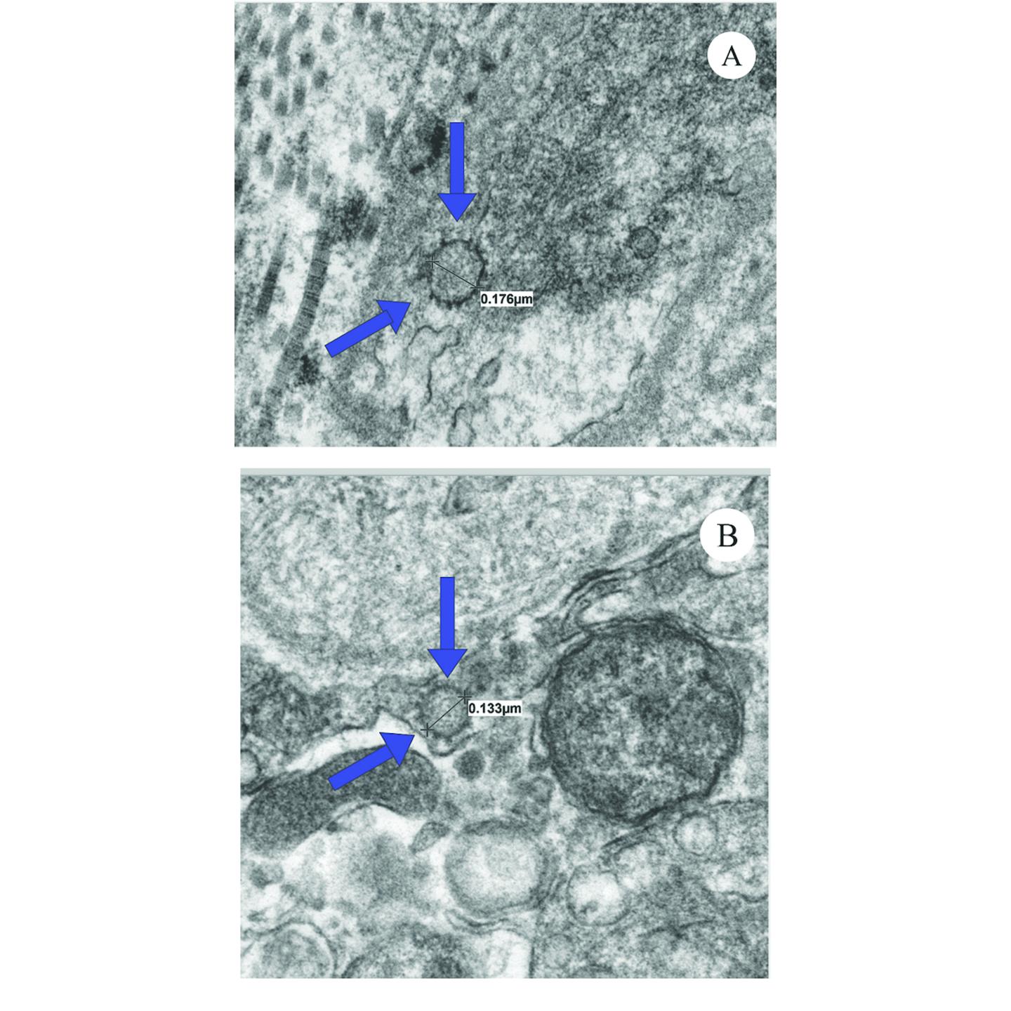 COVID 19 cells in penis tissue IMAGE EurekAlert Science News