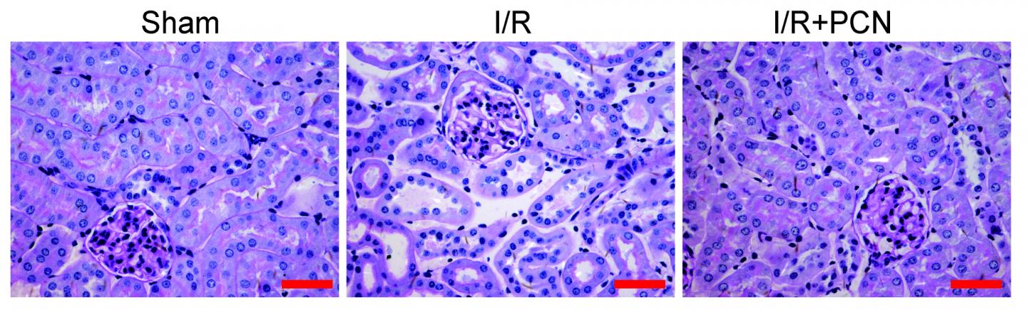 Getting to the Nucleus of Acute Kidney Injury (1 of 1)