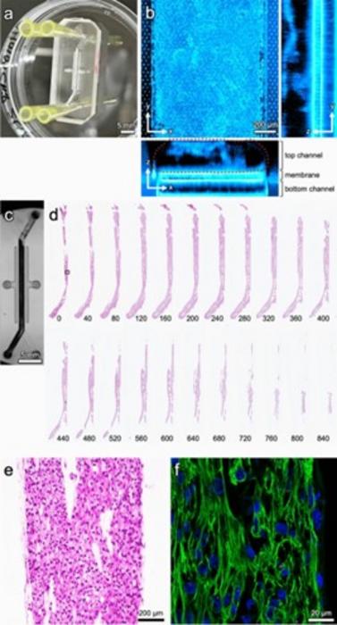 3D Tri-culture Heart-On-A-Chip