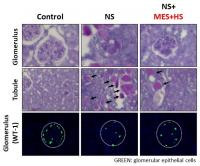 MES+HS ameliorates glomerular and tubular damage in ADR-induced NS and reduces the number of podocytes