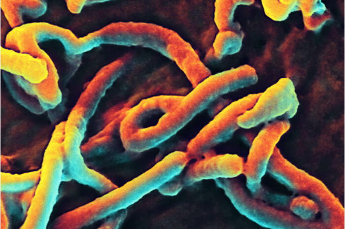 Rapid Ebola diagnosis may be possible with new technology