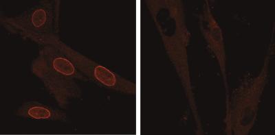 Tpr Excluded from Nucleus of HGPS Patient