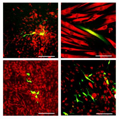 The Multipotency of Reprogrammed Neural Crest Cells
