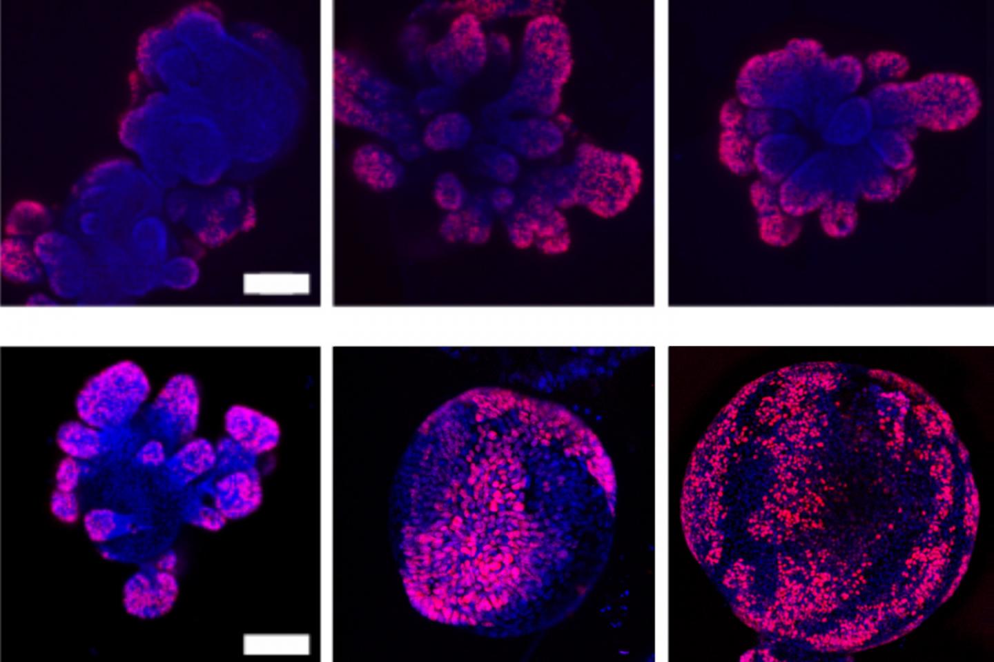 Cell crowding