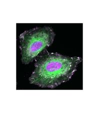 Ran -- Cellules Cancer