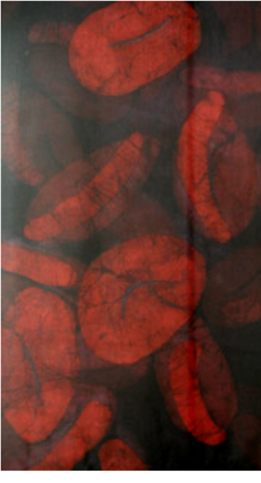 Illustration of Infected Red Blood Cells