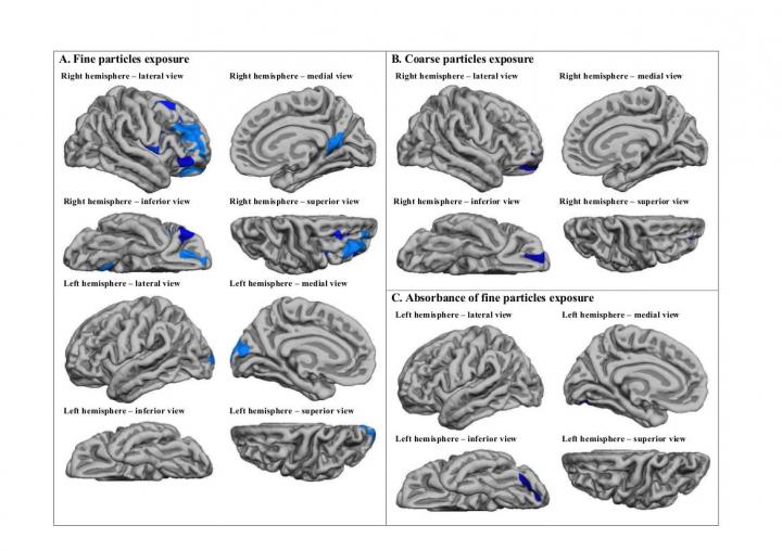 Brain Regions Affected by Fine and Coarse Particles