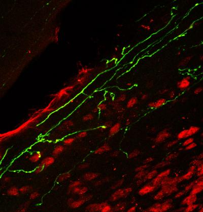 Targeting Derm-BOT to Neurons