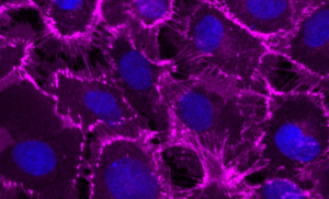 Mesothelial Cells