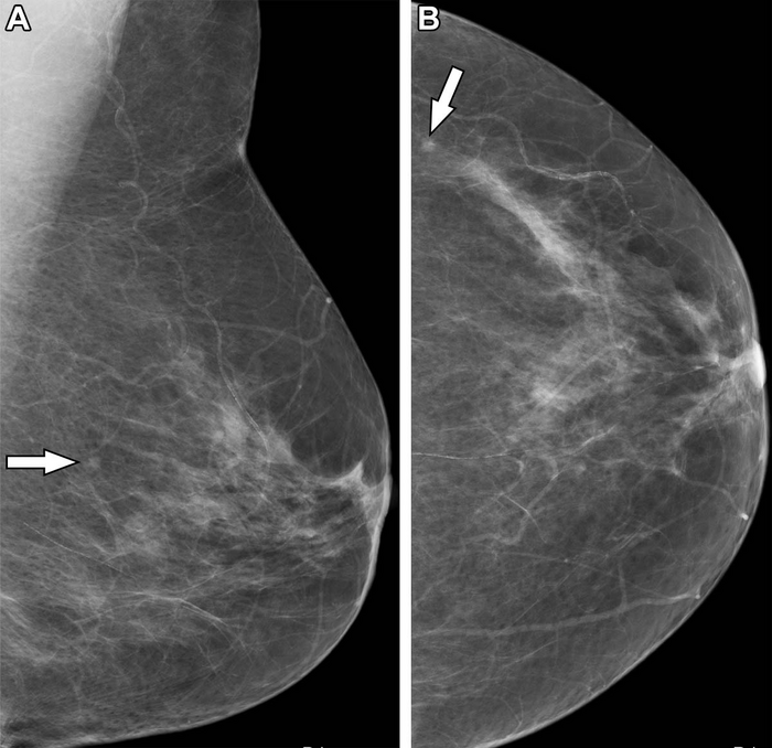 Trained Radiographers May Be a Solution for the Radiologist Shortage