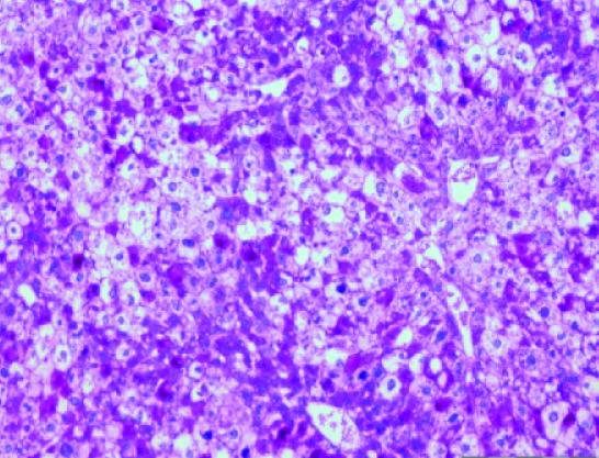 Glycogen High Content