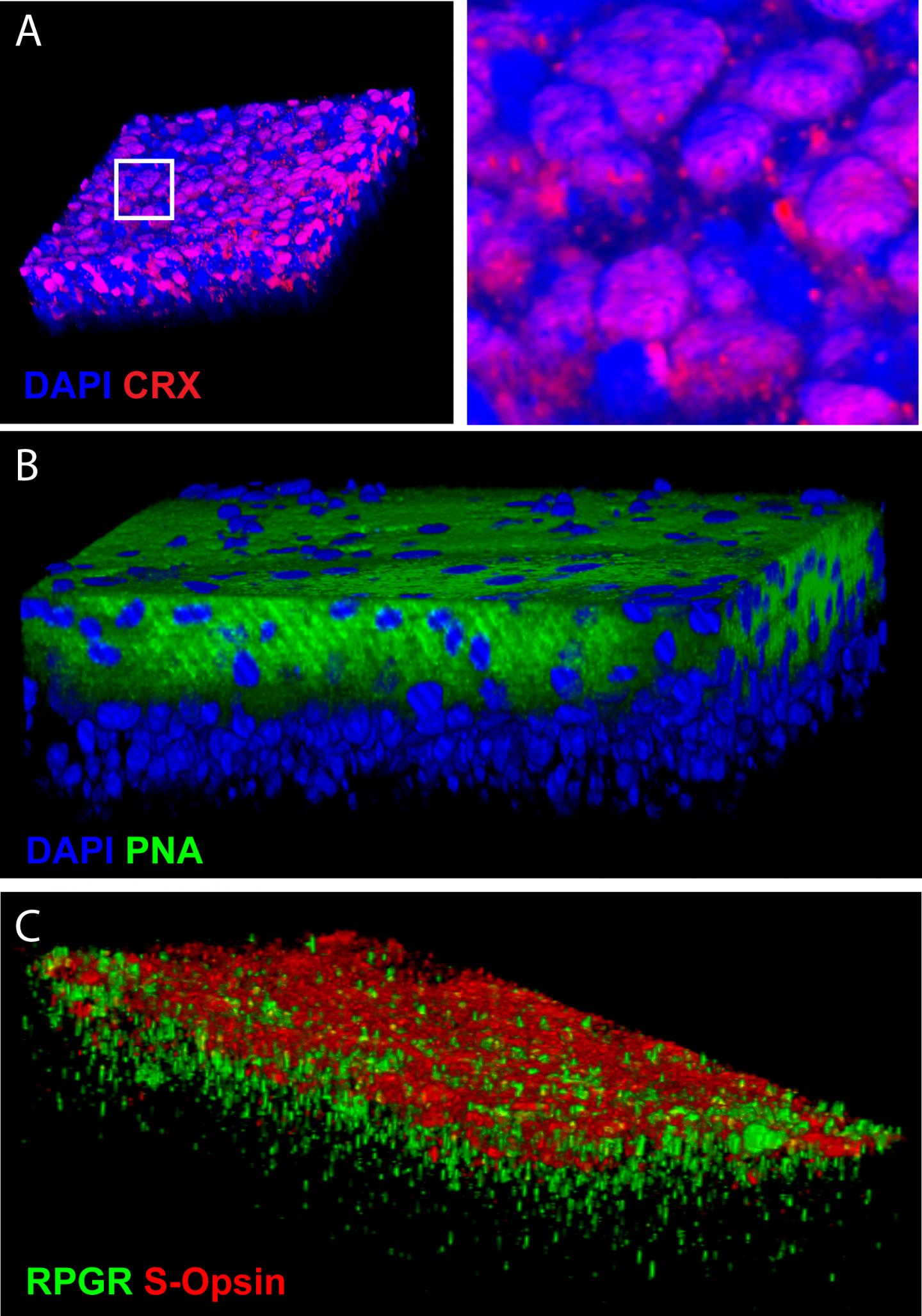 Restoring Vision with Stem Cells (1 of 2)