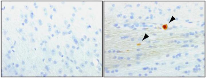 Cell Death in the Absence of LRRK