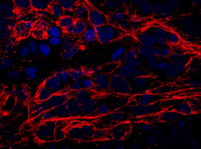 Cardiomyocytes [IMAGE] EurekAlert! Science News Releases