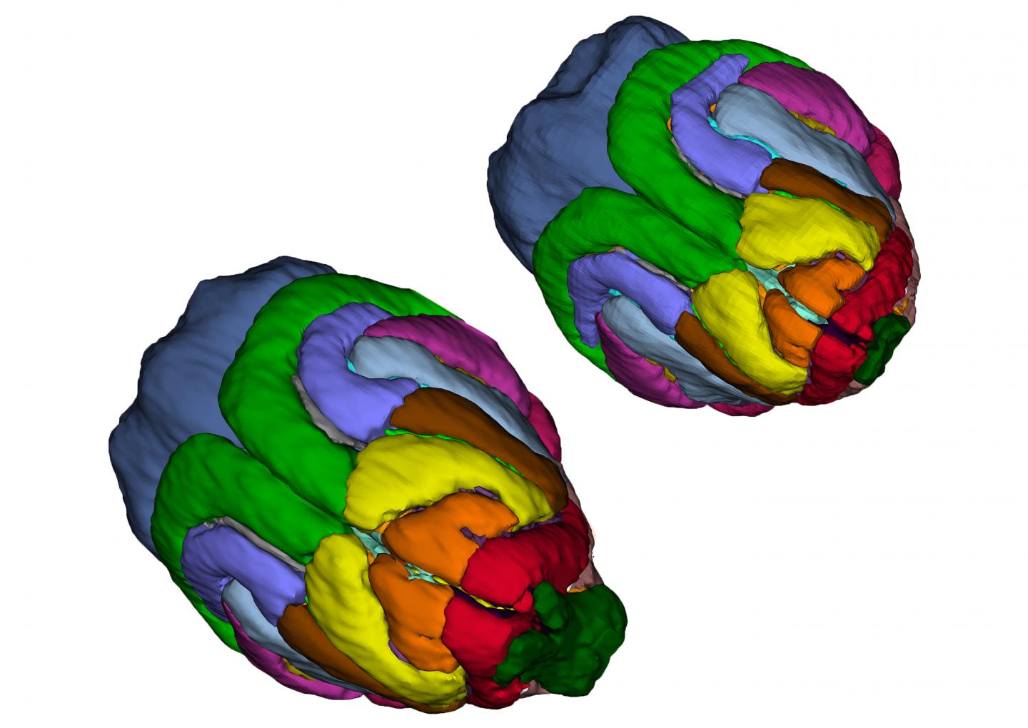 Ferret Brain [IMAGE] EurekAlert! Science News Releases