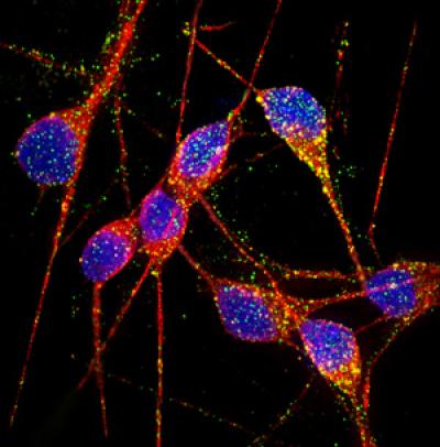 iPSC-Derived Alzheimer's Neurons