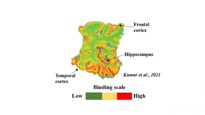Illustration binding of the PET-tracer