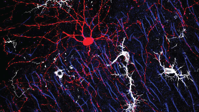 Microglia and Chandelier Cells