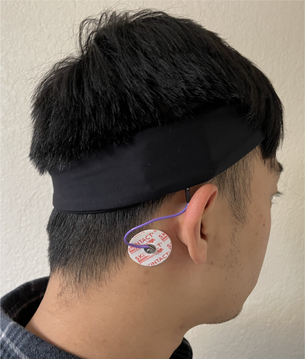 EEG electrode 1